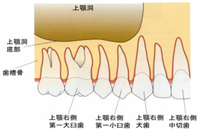 http://www.implant-map.jp/imp8/s-01.jpg