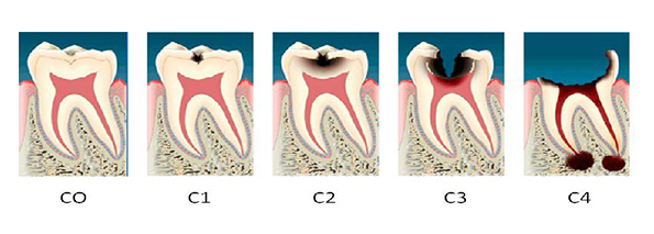 C0-C1-C2-C3-C4